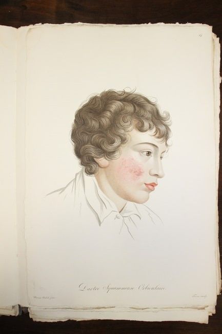 ALIBERT (Jean-Louis), Description des maladies...
